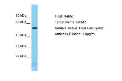 Western Blot: GCM2 Antibody [NBP2-86648] - Host: Rabbit. Target Name: GCM2. Sample Tissue: Human Hela Whole Cell. Antibody Dilution: 1ug/ml