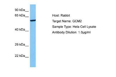 Western Blot: GCM2 Antibody [NBP2-86649] - Host: Rabbit. Target Name: GCM2. Sample Tissue: Human Hela Whole Cell lysates. Antibody Dilution: 1ug/ml