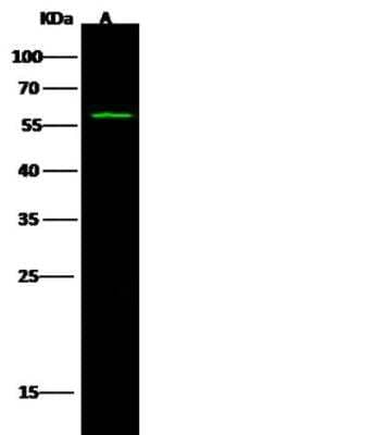 Western Blot: GCM2 Antibody [NBP2-98880] - Lane A: A431 Whole Cell Lysate Lysates/proteins at 30 ug per lane.Secondary Goat Anti- Rabbit  IgG H&L (Dylight 800)  at 1/10000 dilution.Developed using the Odyssey technique. Performed under reducing conditions.Predicted band size:56 kDa Observed band size:56 kDa