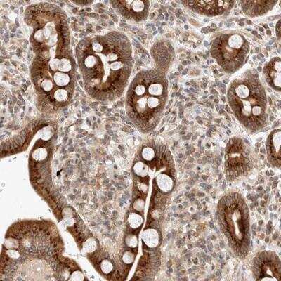 Immunohistochemistry-Paraffin: GCN1L1 Antibody [NBP1-83381] - Staining of human duodenum shows strong cytoplasmic positivity in glandular cells.