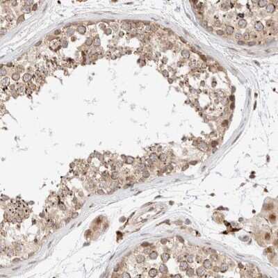 Immunohistochemistry-Paraffin GCN1L1 Antibody