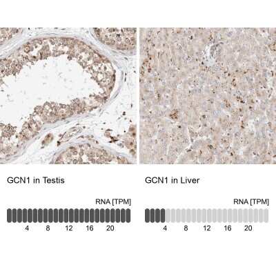 Immunohistochemistry-Paraffin GCN1L1 Antibody