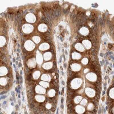 Immunohistochemistry-Paraffin: GCN1L1 Antibody [NBP1-83381] - Staining of human colon.