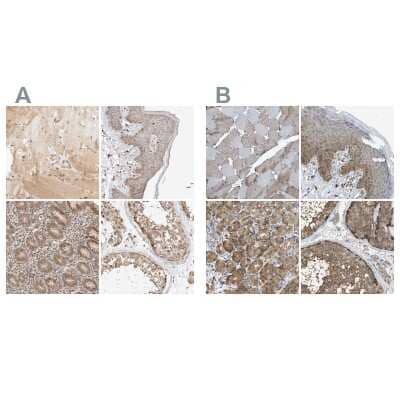 Immunohistochemistry-Paraffin: GCN1L1 Antibody [NBP1-83381] - Staining of human skeletal muscle, skin, stomach and testis using Anti-GCN1L1 antibody NBP1-83381 (A) shows similar protein distribution across tissues to independent antibody NBP1-83383 (B).