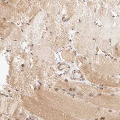 Immunohistochemistry-Paraffin: GCN1L1 Antibody [NBP1-83381] - Staining of human skeletal muscle shows moderate cytoplasmic positivity in myocytes.