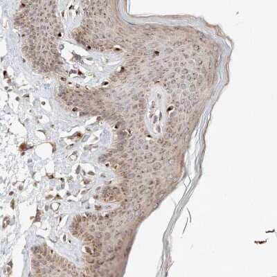 Immunohistochemistry-Paraffin: GCN1L1 Antibody [NBP1-83381] - Staining of human skin shows moderate cytoplasmic positivity in squamous epithelial cells.