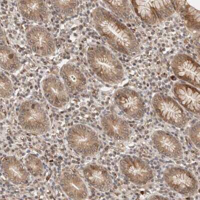 Immunohistochemistry-Paraffin: GCN1L1 Antibody [NBP1-83381] - Staining of human stomach shows  strong cytoplasmic positivity in glandular cells.