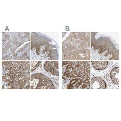 Immunohistochemistry-Paraffin GCN1L1 Antibody