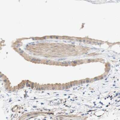 Immunohistochemistry-Paraffin: GCN2 Antibody [NBP2-38126] - Staining of human gallbladder shows weak cytoplasmic positivity in glandular cells.