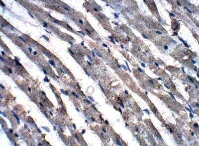 Immunohistochemistry-Paraffin: GCN2 Antibody [NBP3-12273] - Rat heart. 1:100 dilution in IHC blocking buffer. DAB (brown) substrate. Hematoxylin QS (blue) counter stain. 40X magnfication.