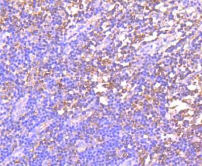 Immunohistochemistry-Paraffin: GCN2 Antibody (JA03-83) [NBP2-66865] - Analysis of paraffin-embedded human tonsil tissue using anti-GCN2 antibody. Counter stained with hematoxylin.