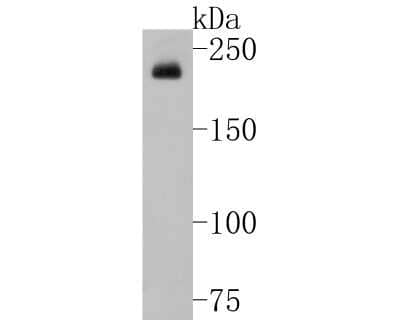 Western Blot: GCN2 Antibody (JA03-83) [NBP2-66865] - Western blot analysis of GCN2 on SKOV-3 cell lysates. Proteins were transferred to a PVDF membrane and blocked with 5% BSA in PBS for 1 hour at room temperature. The primary antibody (1/500) was used in 5% BSA at room temperature for 2 hours. Goat Anti-Rabbit IgG - HRP Secondary Antibody (HA1001) at 1:5,000 dilution was used for 1 hour at room temperature.