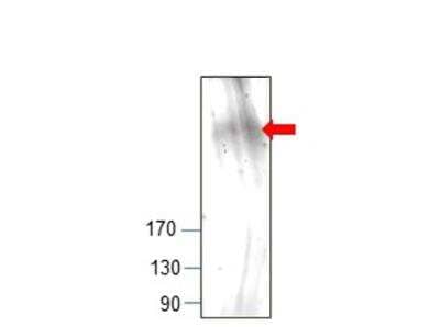 Western Blot: GCN2 Antibody [NBP3-12274] - Kidney extract. Antibody diluiton 1:500 in DiluObuffer. Apparent MW is 240 KDa.