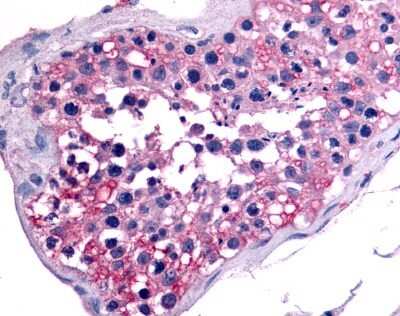 Immunohistochemistry-Paraffin: GCNF/NR6A1 Antibody [NLS5738] - Analysis of anti-NR6A1 / GCNF antibody with human testis.
