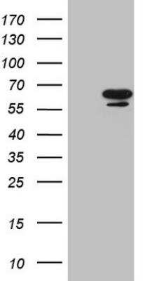 Western Blot: GCNF/NR6A1 Antibody (OTI6F3) [NBP2-46257] - HEK293T cells were transfected with the pCMV6-ENTRY control (Left lane) or pCMV6-ENTRY NR6A1 (Right lane) cDNA for 48 hrs and lysed. Equivalent amounts of cell lysates (5 ug per lane) were separated by SDS-PAGE and immunoblotted with anti-NR6A1. 