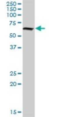 Western Blot: GCNF/NR6A1 Antibody [H00002649-D01P] - Analysis of NR6A1 expression in human liver.