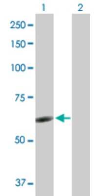 Western Blot: GCNF/NR6A1 Antibody [H00002649-D01P] - Analysis of NR6A1 expression in transfected 293T cell line by NR6A1 polyclonal antibody.Lane 1: NR6A1 transfected lysate(53.90 KDa).Lane 2: Non-transfected lysate.