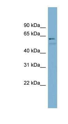 Western Blot: GCNF/NR6A1 Antibody [NBP1-52891] - PANC1 cell lysate, concentration 0.2-1 ug/ml.