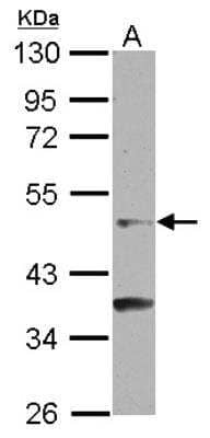 Western Blot: GCNF/NR6A1 Antibody [NBP2-16625] - Sample (30 ug of whole cell lysate) A: NT2D1 10% SDS PAGE gel, diluted at 1:500.