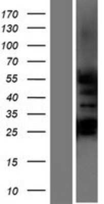 Western Blot GCNF/NR6A1 Overexpression Lysate