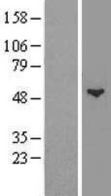 Western Blot: GCNT1 Overexpression Lysate (Adult Normal) [NBP2-08274] Left-Empty vector transfected control cell lysate (HEK293 cell lysate); Right -Over-expression Lysate for GCNT1.