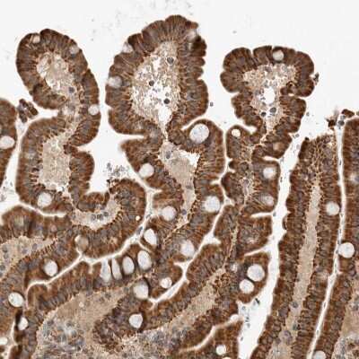 Immunohistochemistry-Paraffin GCNT2 Antibody