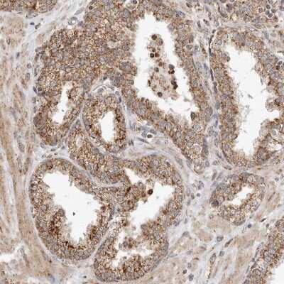 Immunohistochemistry-Paraffin GCNT2 Antibody