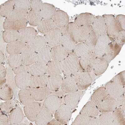 Immunohistochemistry-Paraffin: GCNT2 Antibody [NBP1-88781] - Staining of human Skeletal muscle shows no positivity in myocytes as expected.