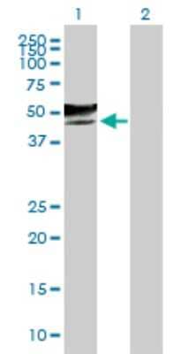 Western Blot: GCNT2 Antibody [H00002651-B01P] - Analysis of GCNT2 expression in transfected 293T cell line by GCNT2 polyclonal antibody.  Lane1:GCNT2 transfected lysate(44.22 KDa). Lane2:Non-transfected lysate.