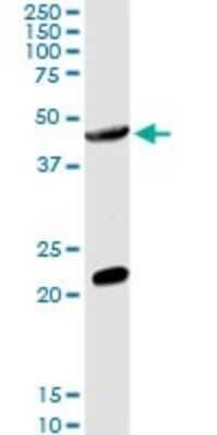 Western Blot GCNT2 Antibody - Azide and BSA Free