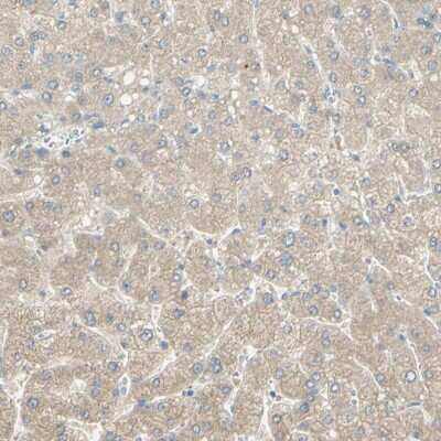 Immunohistochemistry-Paraffin GCNT3 Antibody