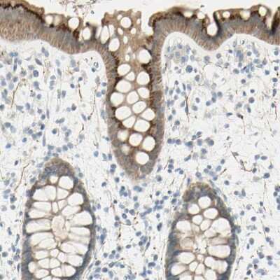 Immunohistochemistry-Paraffin GCNT3 Antibody