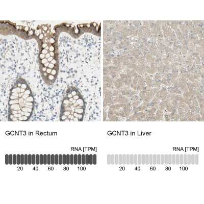 Immunohistochemistry-Paraffin: GCNT3 Antibody [NBP1-88313] - Staining in human rectum and liver tissues using anti-GCNT3 antibody. Corresponding GCNT3 RNA-seq data are presented for the same tissues.