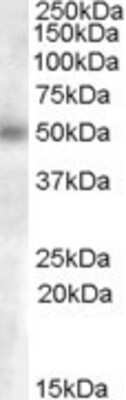 Western Blot: GCNT3 Antibody [NB100-93400] - (0.3ug/ml) staining of human lymph node lysate (35ug protein in RIPA buffer). Primary incubation was 1 hour. Detected by chemiluminescence.