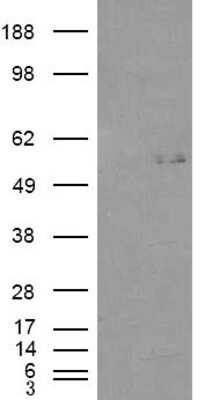 Western Blot: GCNT3 Antibody [NB100-93400] - HEK293 overexpressing GCNT3 and probed with (mock transfection in first lane).