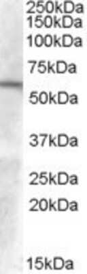 Western Blot: GCNT3 Antibody [NB100-93401] - Analysis of GCNT3 (aa 410 to 422) in Human Duodenum lysate (35ug protein in RIPA buffer) using this antibody at 0.1ug/ml. Primary incubation was 1 hour. Detected by chemiluminescence.