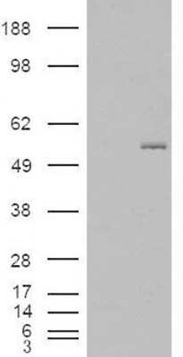 Western Blot: GCNT3 Antibody [NB100-93401] - HEK293 overexpressing GCNT3 and probed with (mock transfection in first lane).