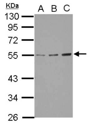 Western Blot: GCNT3 Antibody [NBP2-16626] - Sample (30 ug of whole cell lysate) A: A549 B: H1299 C: HCT116 10% SDS PAGE gel, diluted at 1:1000.