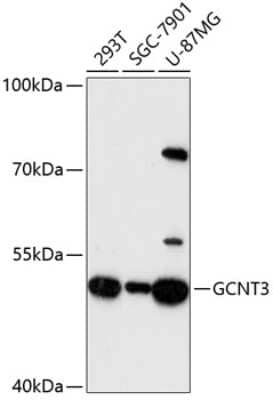 Western Blot: GCNT3 Antibody [NBP3-04915] - Analysis of extracts of various cell lines, using GCNT3 antibody at 1:3000 dilution. Secondary antibody: HRP Goat Anti-Rabbit IgG (H+L) at 1:10000 dilution. Lysates/proteins: 25ug per lane. Blocking buffer: 3% nonfat dry milk in TBST. Detection: ECL Enhanced Kit.
