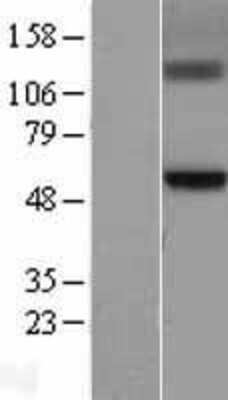 Western Blot: GCNT3 Overexpression Lysate (Adult Normal) [NBL1-11016] Left-Empty vector transfected control cell lysate (HEK293 cell lysate); Right -Over-expression Lysate for GCNT3.
