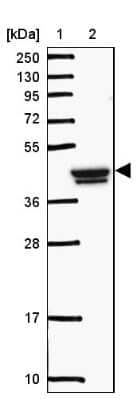 Western Blot: GCNT7 Antibody [NBP2-49055] - Lane 1: Marker [kDa] 250, 130, 95, 72, 55, 36, 28, 17, 10Lane 2: Human cell line RT-4
