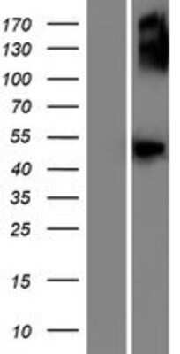 Western Blot: GCNT7 Overexpression Lysate (Adult Normal) [NBP2-09957] Left-Empty vector transfected control cell lysate (HEK293 cell lysate); Right -Over-expression Lysate for GCNT7.