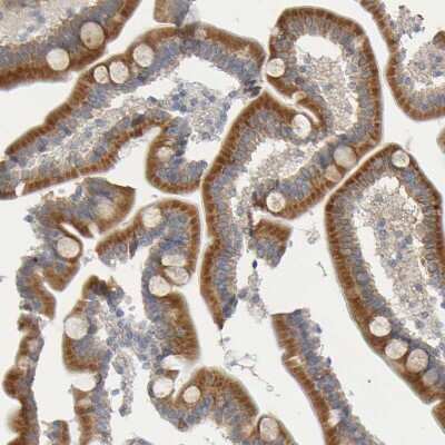 Immunohistochemistry-Paraffin: GCS1 Antibody [NBP1-81839] - Staining of human duodenum shows moderate granular cytoplasmic positivity in glandular cells.