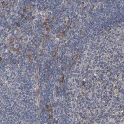 Immunohistochemistry-Paraffin: GCS1 Antibody [NBP1-81839] - Staining of human lymphoid tissues shows moderate  granular cytoplasmic positivity in non-germinal center cells.