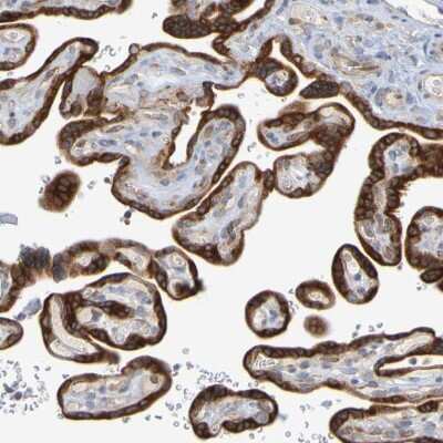 Immunohistochemistry-Paraffin: GCS1 Antibody [NBP1-81839] - Staining of human placenta shows strong granular cytoplasmic positivity in trophoblastic cells.