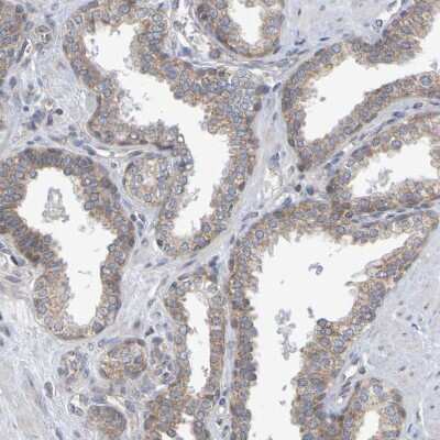 Immunohistochemistry-Paraffin: GCS1 Antibody [NBP1-81839] - Staining of human prostate shows weak  granular cytoplasmic positivity in glandular cells.