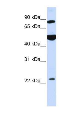 Western Blot: GCS1 Antibody [NBP1-79194] - Hela cell lysate, concentration 0.2-1 ug/ml.