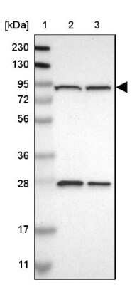 Western Blot: GCS1 Antibody [NBP1-81839] - Lane 1: Marker  [kDa] 230, 130, 95, 72, 56, 36, 28, 17, 11.  Lane 2: Human cell line RT-4.  Lane 3: Human cell line U-251MG sp