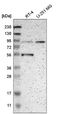 Western Blot: GCS1 Antibody [NBP2-58996] - Western blot analysis in human cell line RT-4 and human cell line U-251 MG.