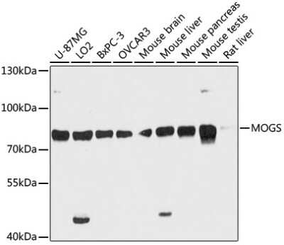 Western Blot: GCS1 Antibody [NBP3-03774] - Analysis of extracts of various cell lines, using GCS1 antibody at 1:3000 dilution. Secondary antibody: HRP Goat Anti-Rabbit IgG (H+L) at 1:10000 dilution. Lysates/proteins: 25ug per lane. Blocking buffer: 3% nonfat dry milk in TBST. Detection: ECL Basic  Kit.